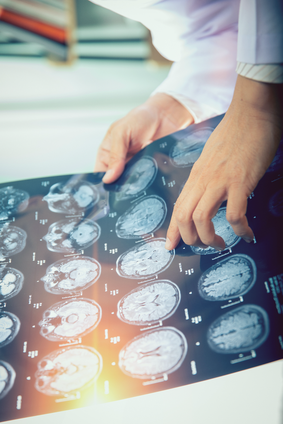 Doctor pointing at and explaining meningioma scan